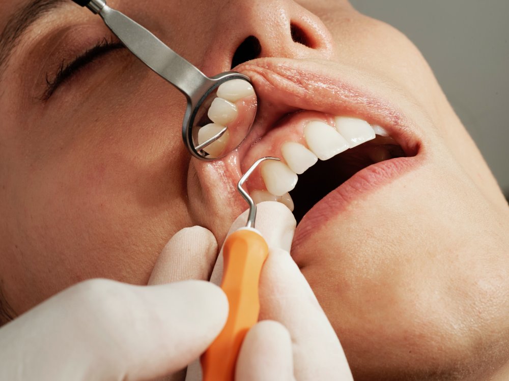 Husker du at besøge din tandlæge i Silkeborg?