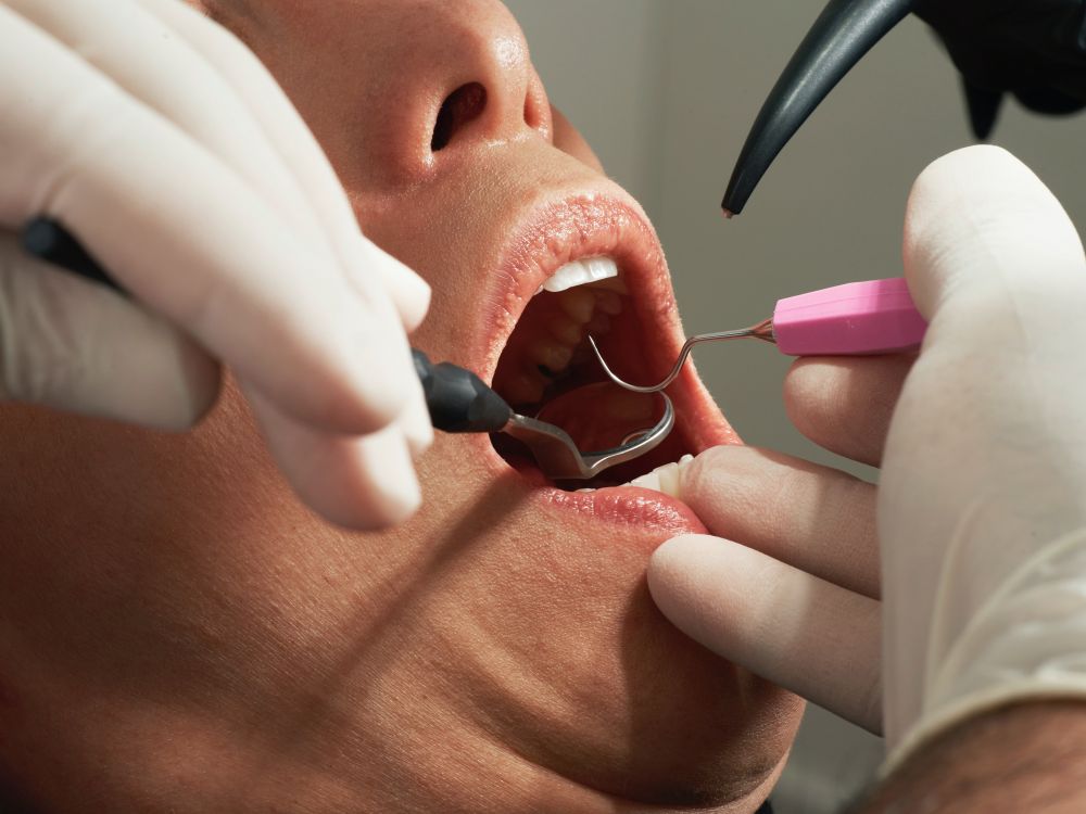 Din tandlæge kan hjælpe dig til sunde tænder